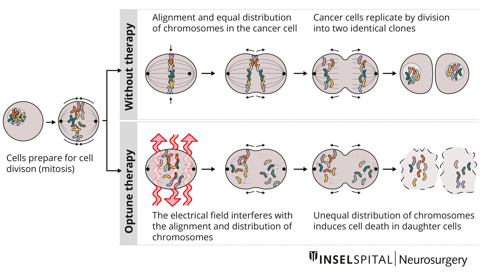 Illustration of how tumor treating fields work