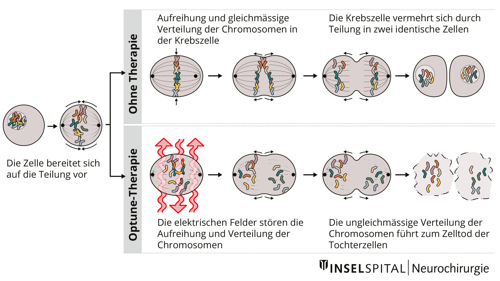 Illustration of the mode of action of tumor treating fields