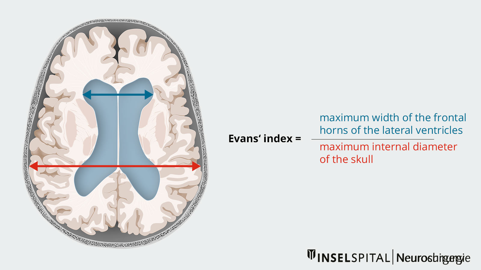 Drawing to illustrate the Evans index