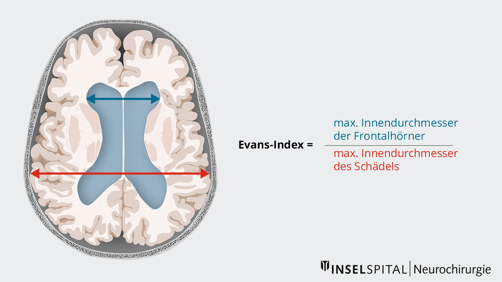 Zeichnung zur Verdeutlichung des Evans-Index