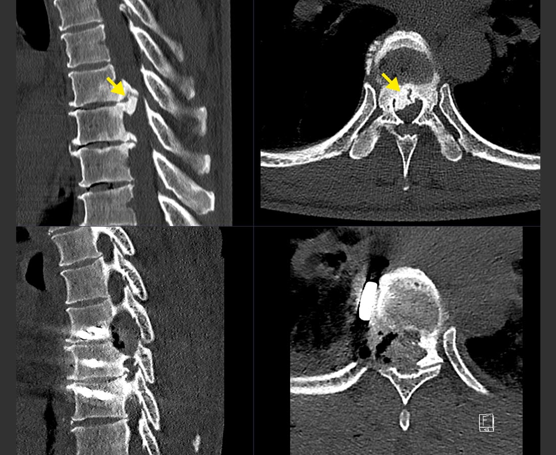 ​CT images​ to compare findings before and after surgery