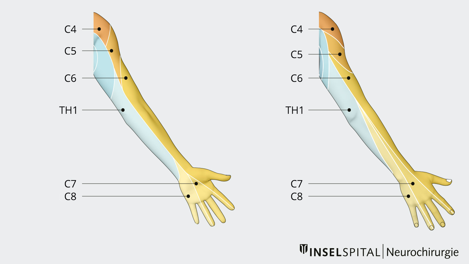 ​Dessin des dermatomes sur la main et le bras