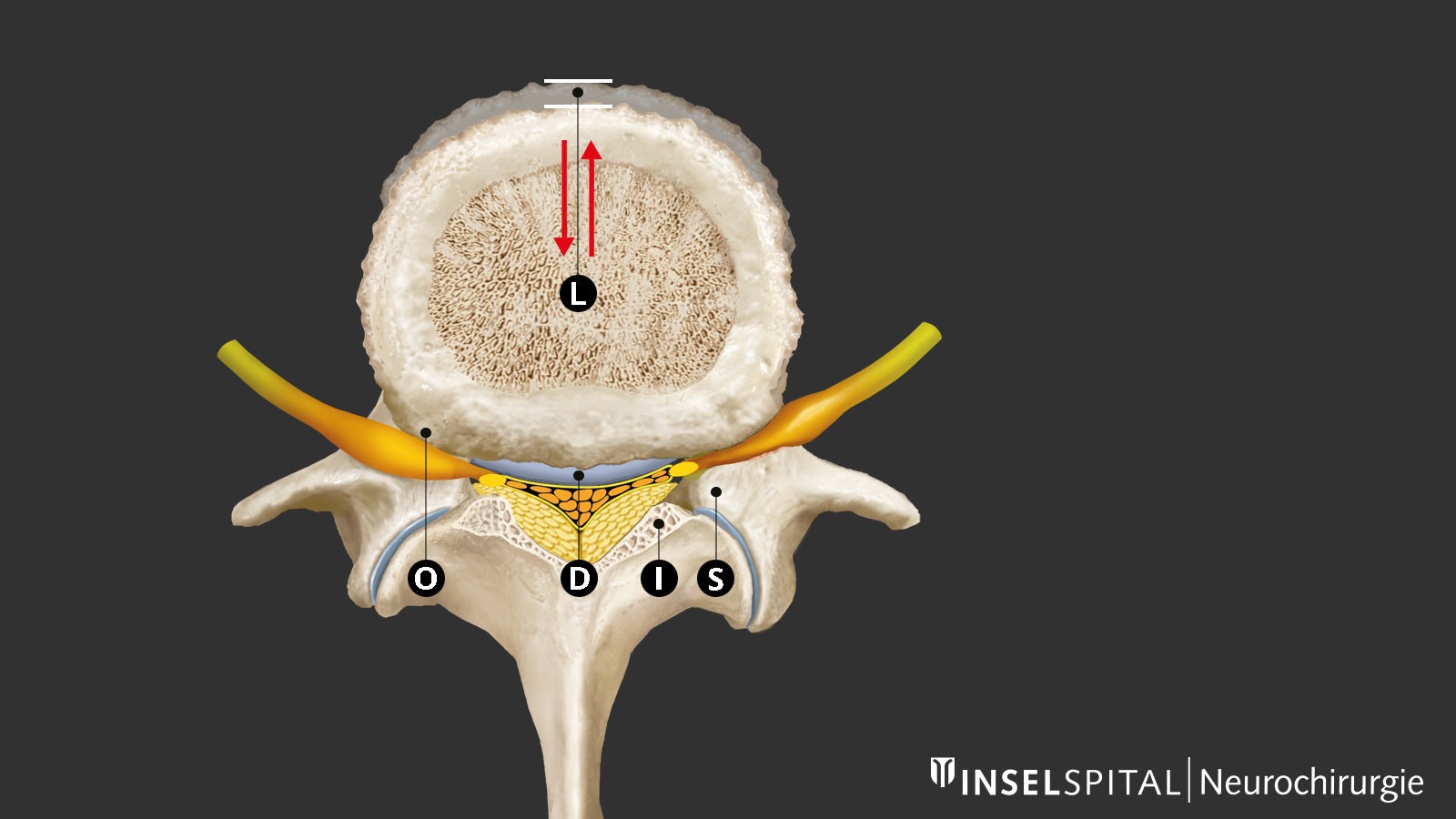 Zeichnung der unterschiedlichen Strukturen des Spinalkanals im Querschnitt